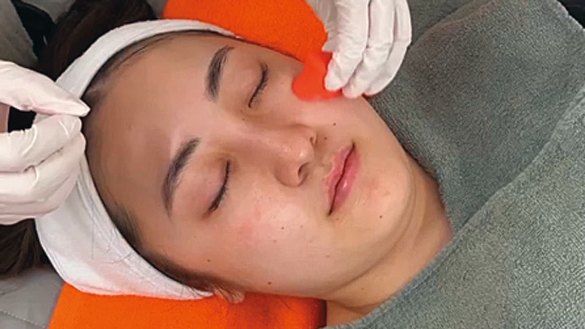 オールラウンドに効く！はじめての美容医療におすすめの【ピーリング】って？