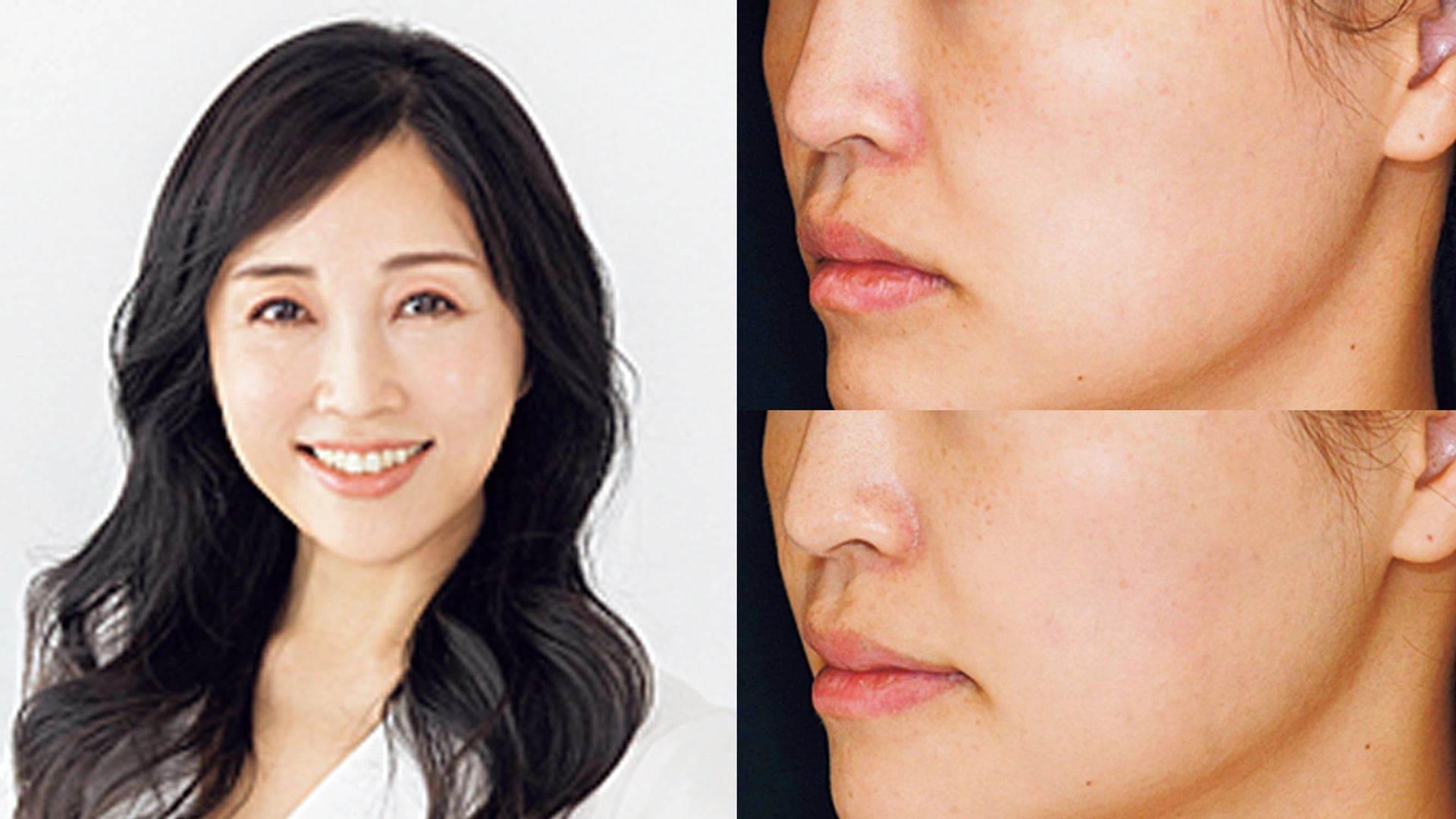 知識がないと取り返しのつかないことに...！話題の美容医療との「正しいつきあい方」とは？